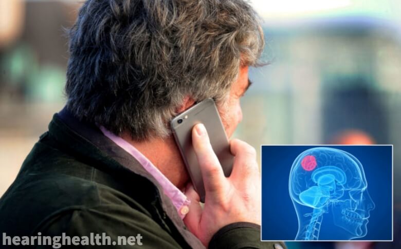 โทรศัพท์ไม่ทำให้เกิดเนื้องอกในสมอง