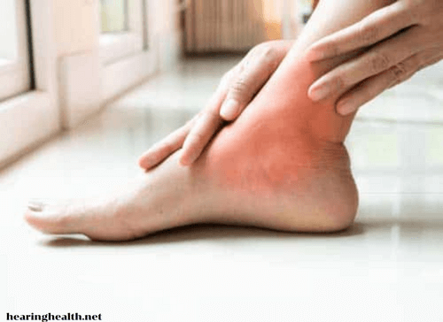 อาการปวดข้อเท้า ง อาการปวดหรือไม่สบายที่ข้อเท้า อาการปวดนี้อาจเกิดจากการบาดเจ็บเช่น เคล็ดขัดยอกหรือจากเงื่อนไขทางการแพทย์ เช่น โรคข้ออักเสบ 