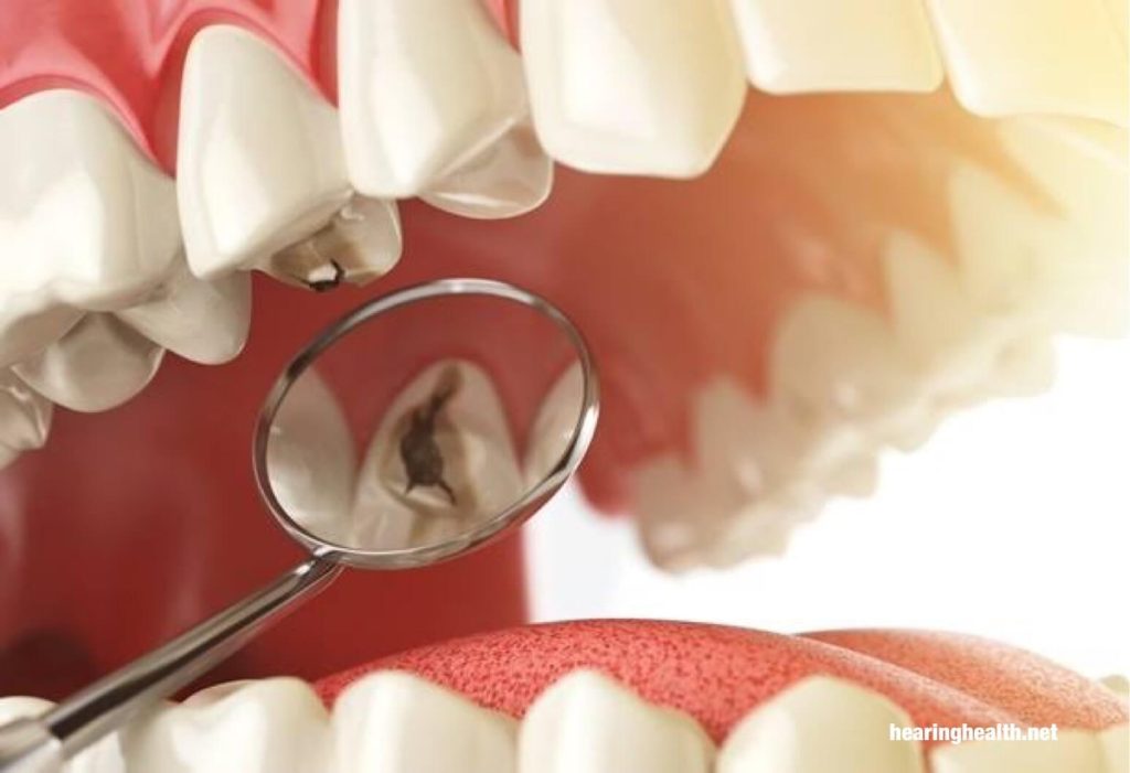 คลองรากฟัน เป็นการรักษาที่ใช้ในการซ่อมแซมและบันทึกฟันที่ผุ หรือ ติดเชื้ออย่างรุนแรง เส้นประสาทและเยื่อกระดาษของฟันอาจระคายเคืองอักเสบ