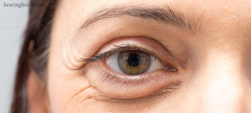 เมื่อคุณอายุมากขึ้น เนื้อเยื่อและกล้ามเนื้อที่รองรับเปลือกตาของคุณจะอ่อนแอลง ทำให้ผิวหย่อนคล้อยและเกิด ถุงใต้ตา 